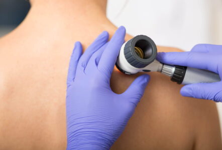 The overlooked occupational hazard - skin cancer and your wellbeing strategy