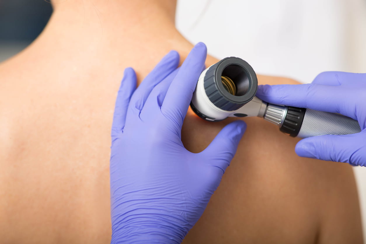 The overlooked occupational hazard - skin cancer and your wellbeing strategy