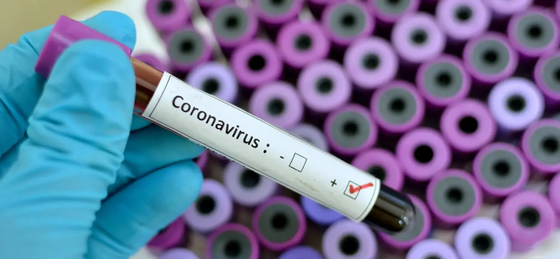 CORONAVIRUS – EMPLOYEE BENEFITS & INSURANCE IMPLICATIONS